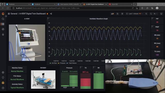 Plotting Ventilator Waveform Using Grafana Dashboard смотреть онлайн