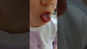 гипертонус. дизартрия. как работать #гипертонус #логопедическиймассаж #логопед