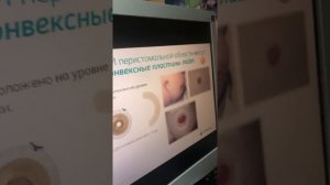 Семинар «Особенности применения конвексных пластин»