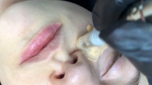 Протокол проведения процедуры BB Glow