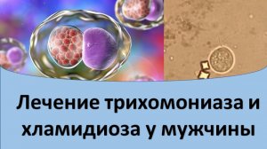 Лечение трихомониаза и хламидиоза у мужчин.