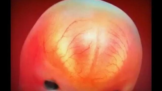 5 6 недель беременности. смотреть онлайн