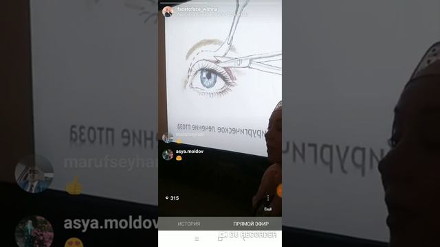 Про птоз верхних век смотреть онлайн