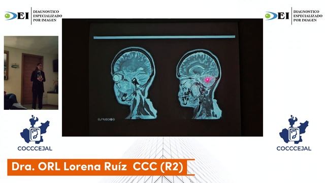 SIH Diciembre 2023 - Onceava Sesión InterHospitalaria COCCCEJAL - Presenta CMNO UMAE IMSS смотреть онлайн