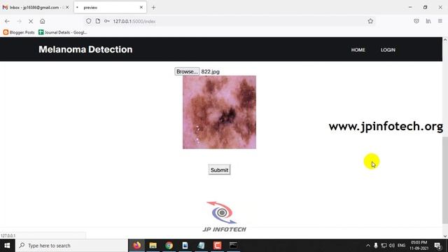 Melanoma Detection Using Convolutional Neural Network | Python Final Year IEEE Project смотреть онлайн