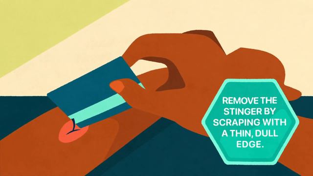 How To Treat A Bee Sting | Merck Manual Consumer Version смотреть онлайн