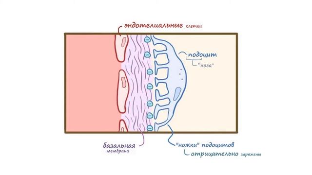 Болезнь Минимальных Изменений (нефротический синдром) лекция смотреть онлайн