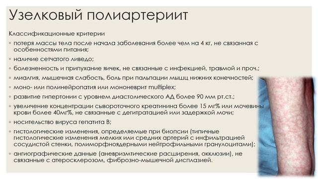 13. Онкология и ревматические заболевания часть 2.mp4 смотреть онлайн