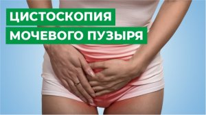 Цистоскопия мочевого пузыря.