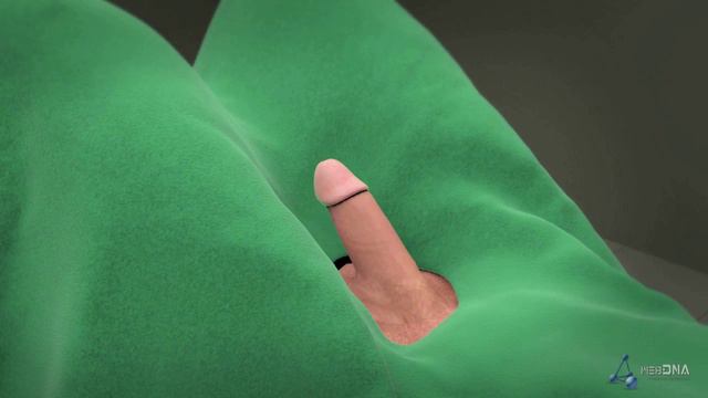 Round Posterior Stent (RPS) Animation Video