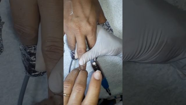 Remoção das unhas acrifix ???? смотреть онлайн