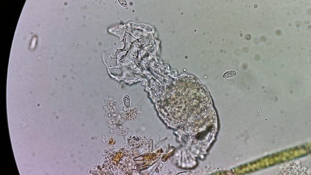 Коловратки (Rotifera) смотреть онлайн