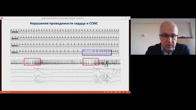 Лекция по обструктивному апноэ сна 2020