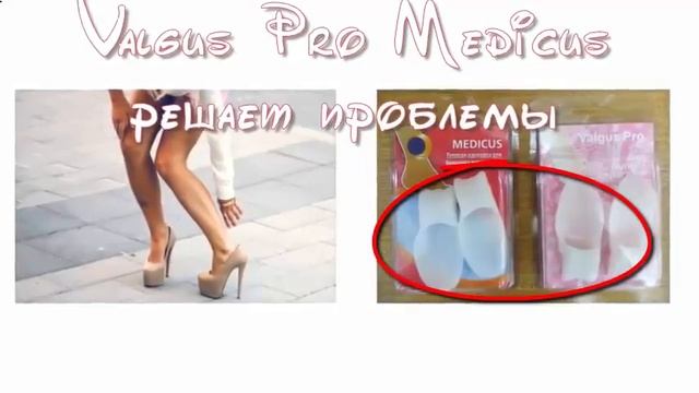 Valgus pro купить в Спб смотреть онлайн