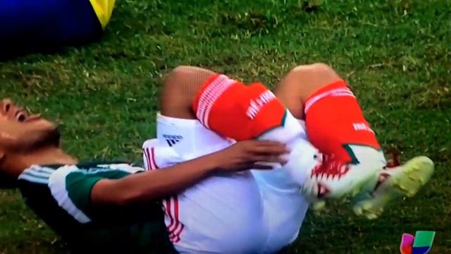 Luis Montes Breaks Leg смотреть онлайн
