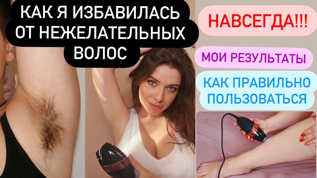 УДАЛЕНИЕ ВОЛОС НАВСЕГДА! ЭПИЛЯЦИЯ. ДОМАШНИЙ ФОТОЭПИЛЯТОР. ГЛАДКАЯ КОЖА. SmoothSkin Bare Plus смотреть онлайн