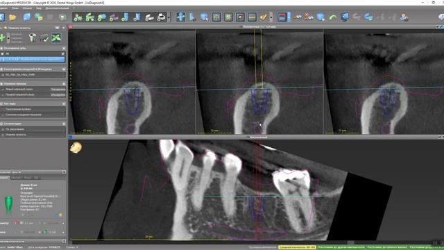 coDiagnostiX Basic training смотреть онлайн