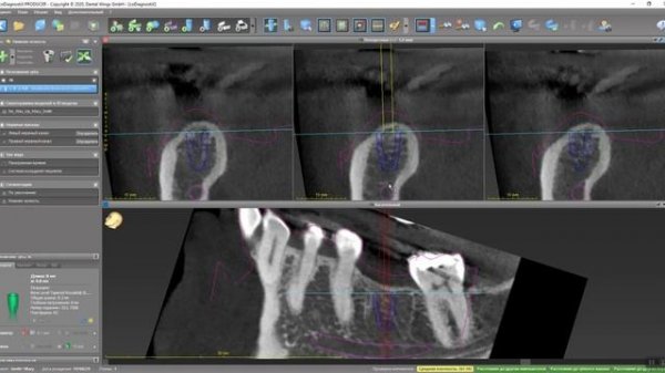 coDiagnostiX Basic training
