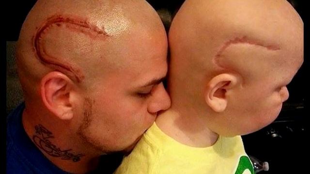 Эта фотография облетела весь мир! Вот что сделал отец ради сына! смотреть онлайн