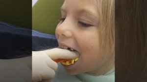 Как детям делают слепки зубов