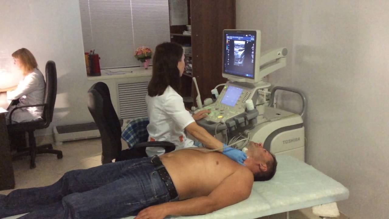 УЗИ сосудов головного мозга и шеи смотреть онлайн