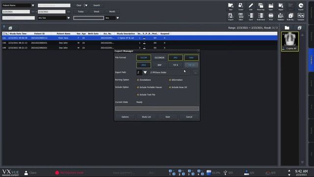VXvue Quick Guide 05. Send and Export X-ray Image смотреть онлайн