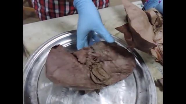 Module 17 - GIT - Practical Anatomy - dr Hazem Gamal - Soft Tissue - Version 2 смотреть онлайн