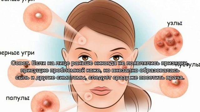 Уход за проблемной кожей лица в домашних условиях смотреть онлайн
