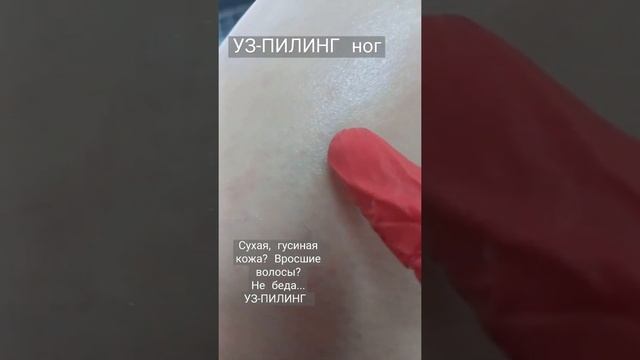 УЗ-ПИЛИНГ НОГ смотреть онлайн