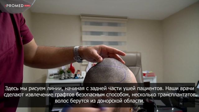 ПЕРЕСАДКА ВОЛОС смотреть онлайн