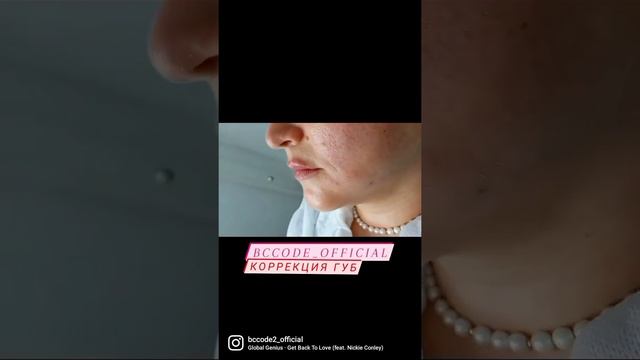 Форма губки, коррекция губ/Москва смотреть онлайн