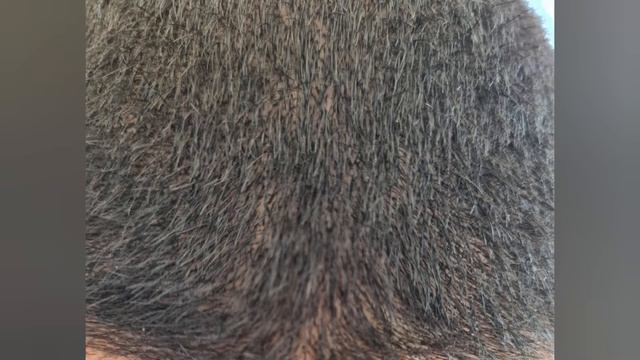 Votala Hair Growth Oil Serum - Does it really work?