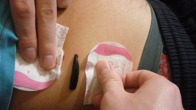 Пиявки. Как мы ставим пиявок в домашних условиях на печень смотреть онлайн