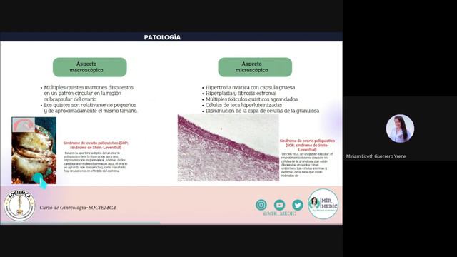 "¡Conoce Más!: Curso de Ginecología sobre el Síndrome de Ovario Poliquístico 🤰" смотреть онлайн