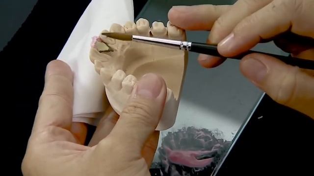 Основные этапы изготовления металлокерамической коронки