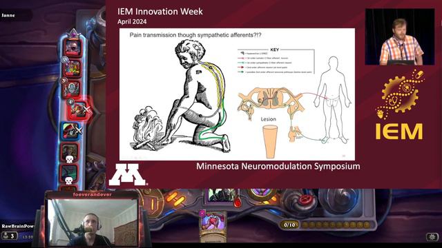 Хронические боли и электростимуляция при травмах спинного мозга, обсуждаем.