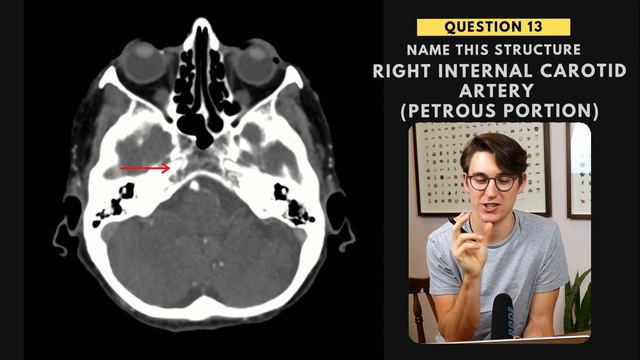 Neuroanatomy practice test: 25 questions with answers and explanations смотреть онлайн