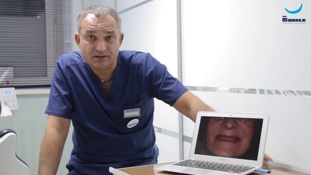 Имплантация Установка съёмных протезов на локаторах Бутаев А С Клиника Dr Smile смотреть онлайн