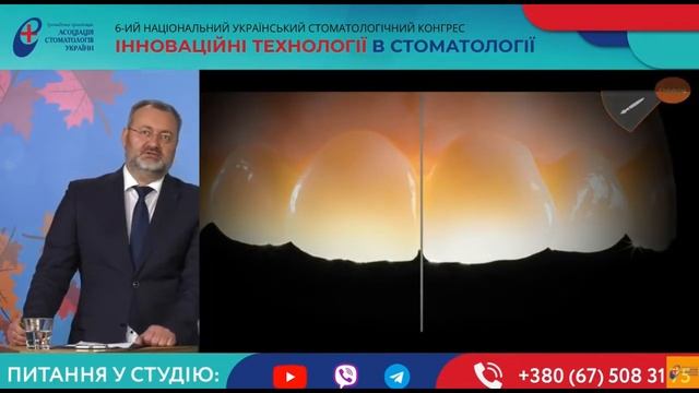 Ротт В., лікар-стоматолог. 6-й Національний український стоматологічний конгрес смотреть онлайн