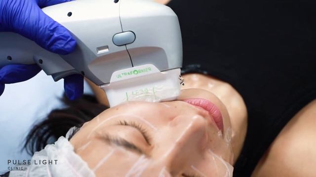 HIFU Skin Tightening | Real People, True Results смотреть онлайн