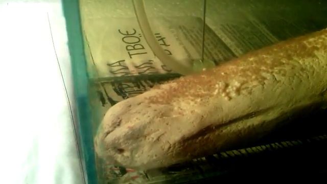 Удаление белой икры смотреть онлайн