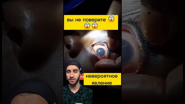 что? черви в глазу? смотреть онлайн