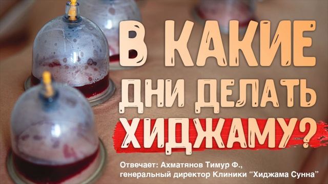 В какие дни делать Хиджаму? | Ахматянов Тимур | II Конференция специалистов по хиджаме смотреть онлайн