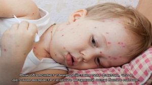 Сколько дней заразна ветрянка?