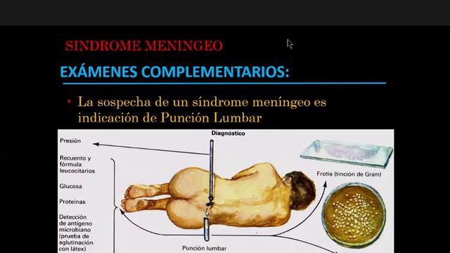 2 NEUROLOGIA 08 06 21 смотреть онлайн