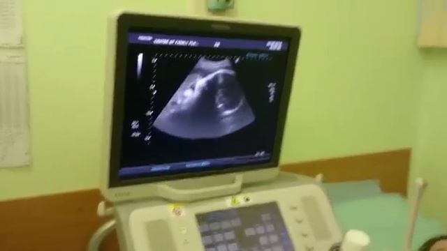 УЗИ Миша смотреть онлайн