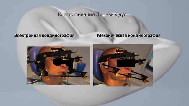 Механические и электронные артикуляторы. Лицевая дуга. Анатомические и функциональные ориентиры. смотреть онлайн