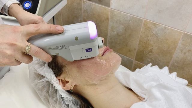 Ультразвуковой SMAS-лифтинг. смотреть онлайн