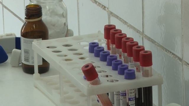 Приближаемся к тысяче. В Ревде увеличилось число зараженных вирусом иммунодефицита человека смотреть онлайн