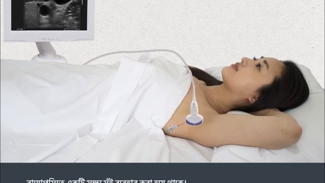Lymph Node Biopsy (Bengali) смотреть онлайн